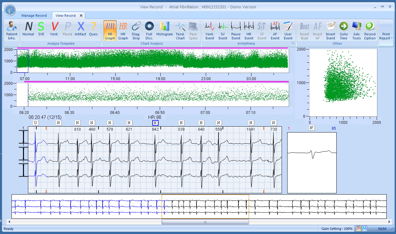 Lumed Holter