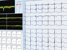 Lumed ECG 2