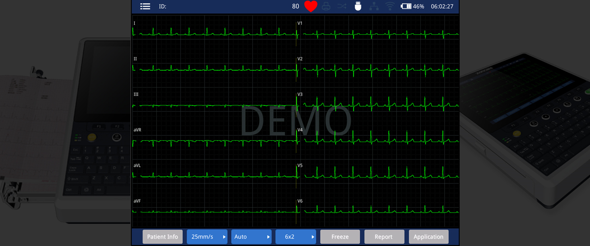 ECG iMAC 300